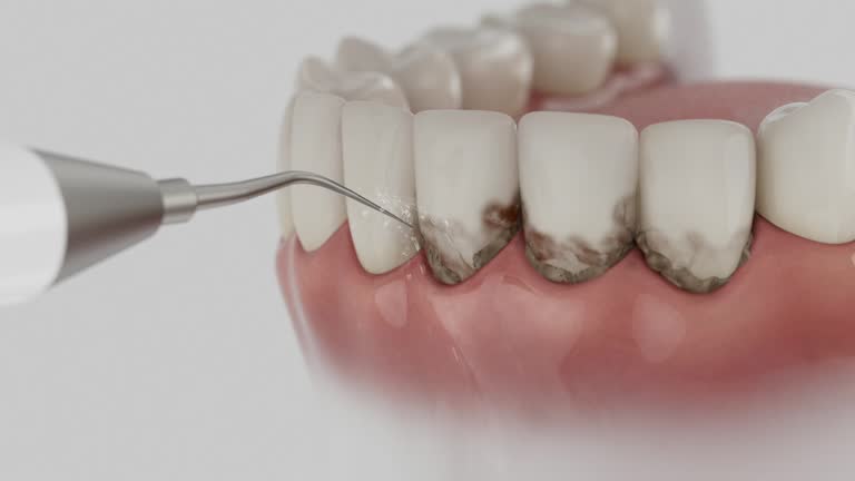 Reliable Dental contractor in Oskaloosa, IA by Dentist Open Now